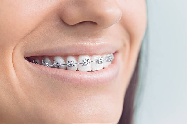 Best Wisdom Tooth Removal  in Terrace Park, OH